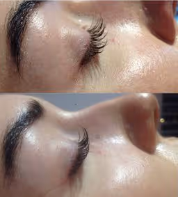 Laminacja + lifting + botox rzęs 1 botox rzes